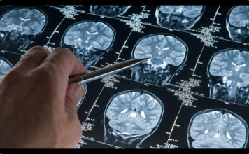 Parkinson und Alzheimer unheilbar? Nein! Neue ursächliche Behandlung